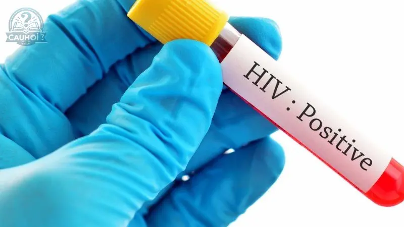Lợi ích của việc xét nghiệm HIV sớm