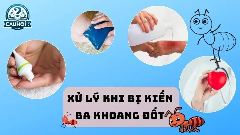 Xử lý khi bị kiến ba khoang đốt Xử lý khi bị kiến ba khoang đốt