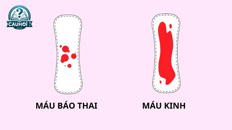 Phân biệt máu báo thai và máu kinh Phân biệt máu báo thai và máu kinh