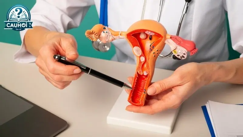 Các biện pháp ngăn ngừa sa tử cung Các biện pháp ngăn ngừa sa tử cung
