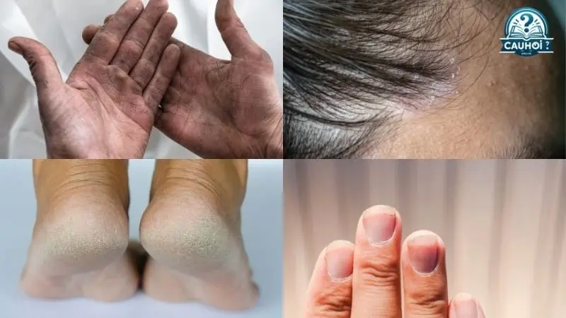 Định nghĩa về "Da bẩn" Định nghĩa về "Da bẩn"
