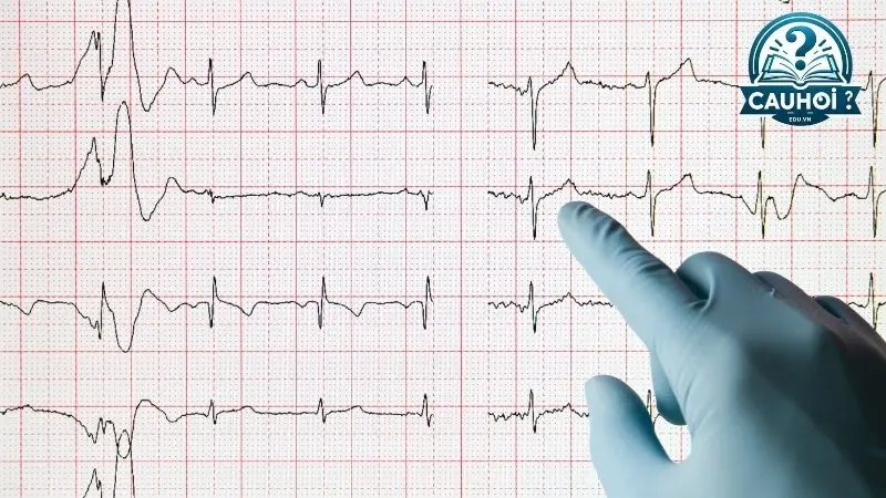 Đọc hiểu kết quả điện tim bình thường Đọc hiểu kết quả điện tim bình thường