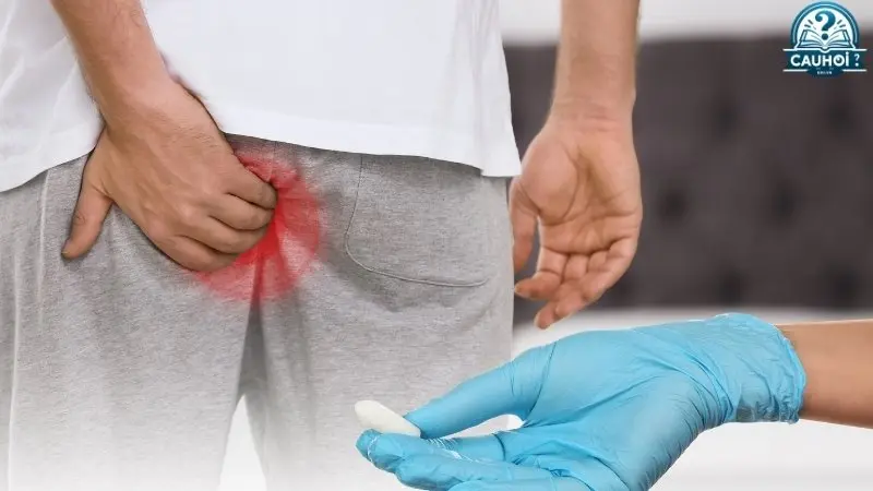 Các phương pháp điều trị trĩ phổ biến Các phương pháp điều trị trĩ phổ biến