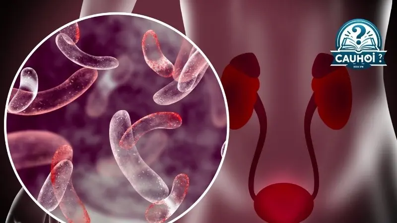 Các bệnh lý có thể phát hiện qua nước tiểu Các bệnh lý có thể phát hiện qua nước tiểu