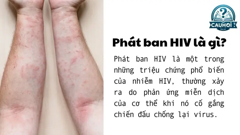 Phát ban HIV là gì? Phát ban HIV là gì?