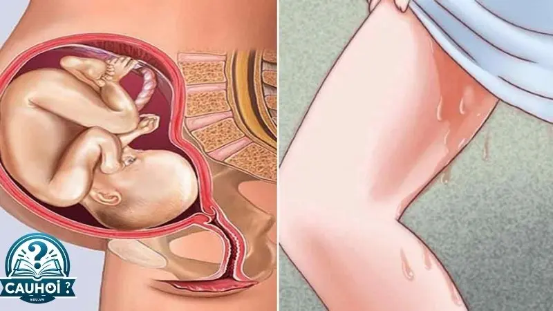 Triệu chứng và cách nhận biết Triệu chứng và cách nhận biết