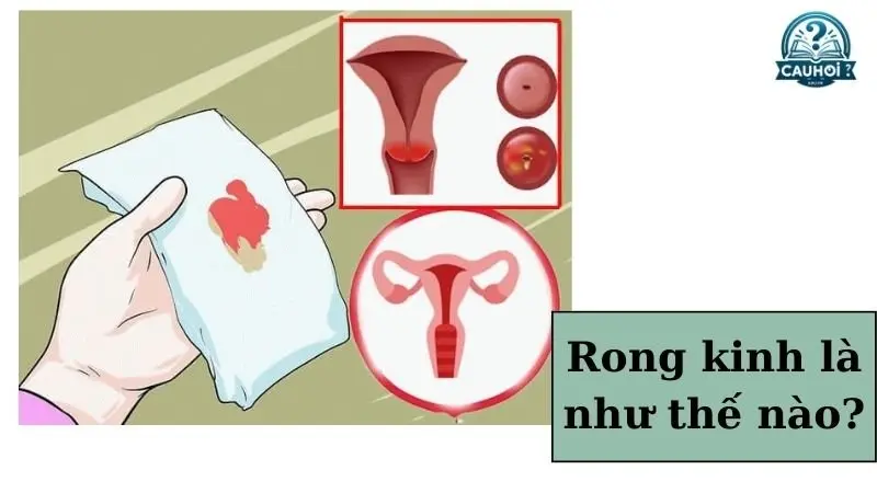 Định nghĩa rong kinh Định nghĩa rong kinh