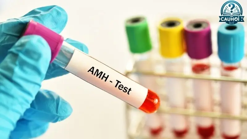 Quy trình xét nghiệm AMH Quy trình xét nghiệm AMH