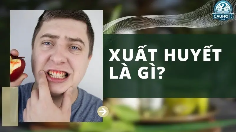 Xuất huyết là gì? Xuất huyết là gì?