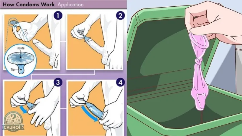 Cách sử dụng bao cao su cho nam giới Cách sử dụng bao cao su cho nam giới