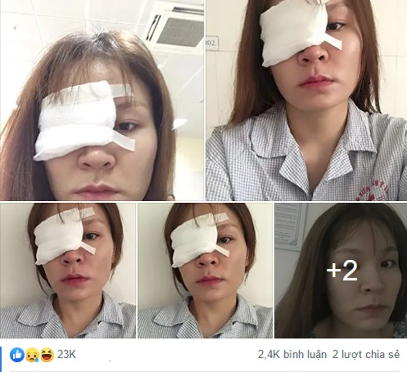 Tác hại của keo 502 1