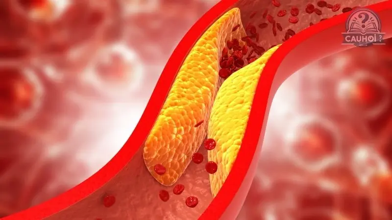 Cholesterol là gì 02