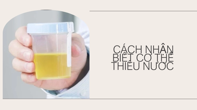 Màu nước tiểu đậm là dấu hiệu cảnh báo cơ thể đang mất nước