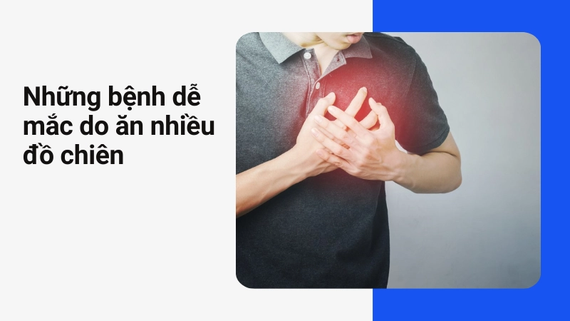 Nguy cơ mắc bệnh tim mạch cao do thường xuyên ăn đồ nhiều dầu mỡ
